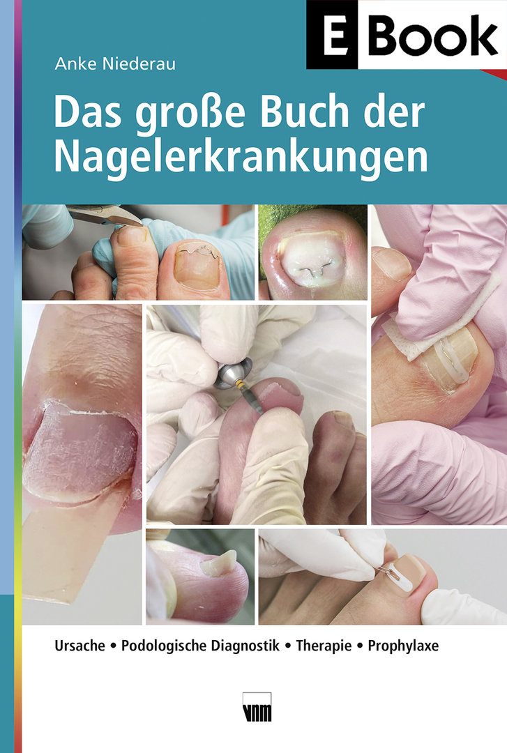 Das große Buch der Nagelerkrankungen - E-Book