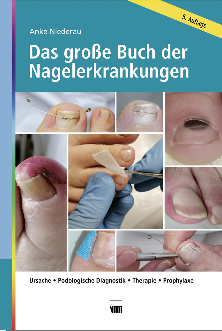 Das große Buch der Nagelerkrankungen - E-Book
